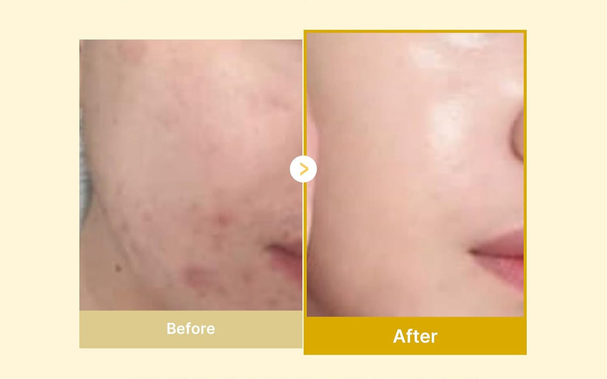 Kojic Acid & Turmeric Overnight Peel-Off Mask with Vitamin C & Retinol