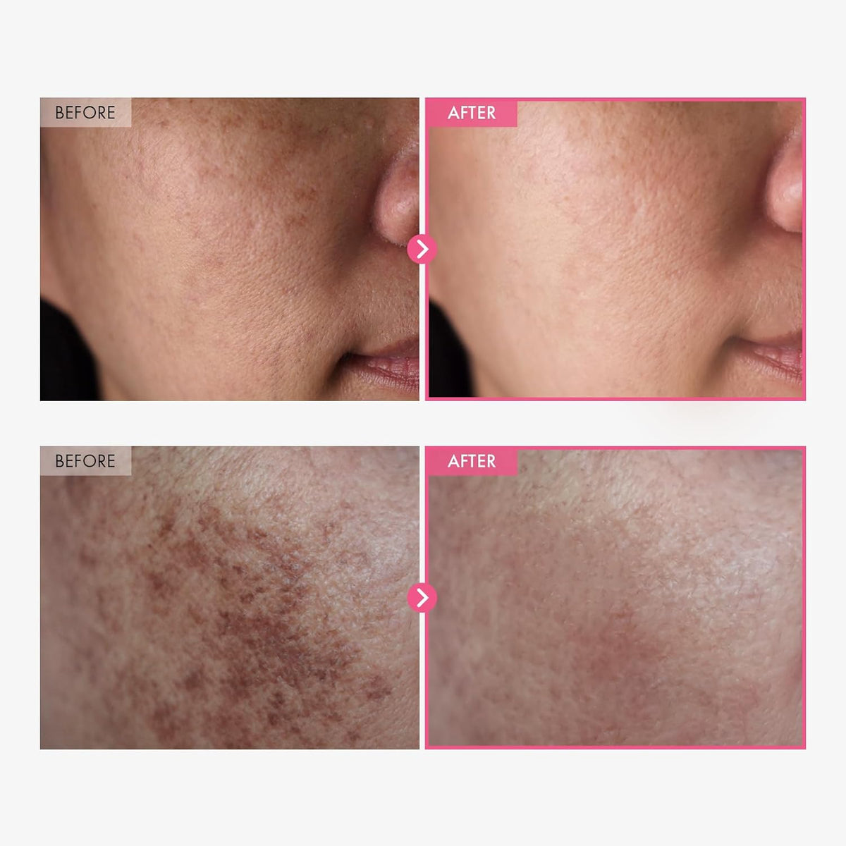 corlaf Advanced Arbutin Brightening Cream