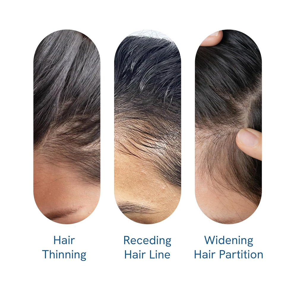 Hair Growth Serum Roll-On with Rosemary, Redensyl & Peptides