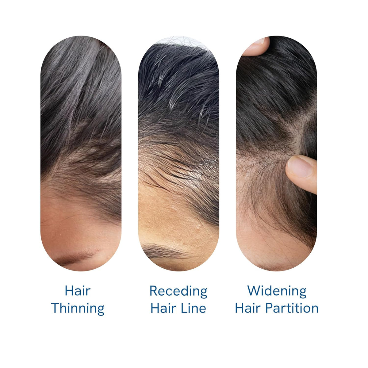 Hair Growth Serum Roll-On with Rosemary, Redensyl & Peptides