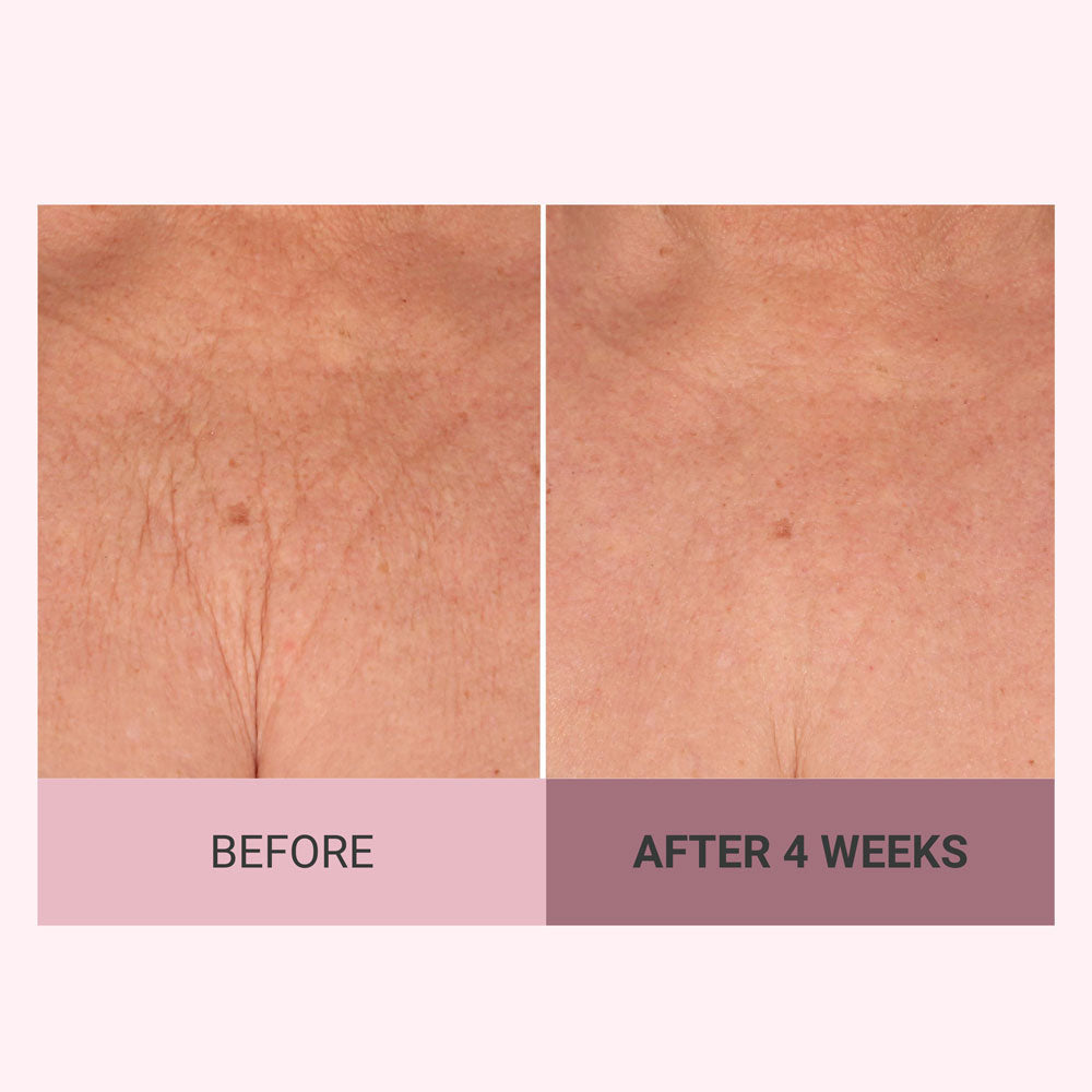 Champagne Firming Body Cream — Luxe-Lift Complex & Pink Pepperslim Firming Formula