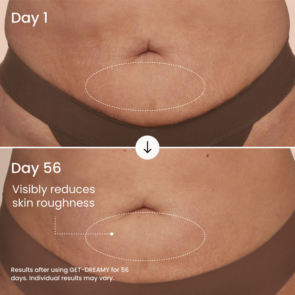GET-DREAMY Overnight Body Whip with Caffeine, Peptides & Magnesium for Uneven Skin Texture