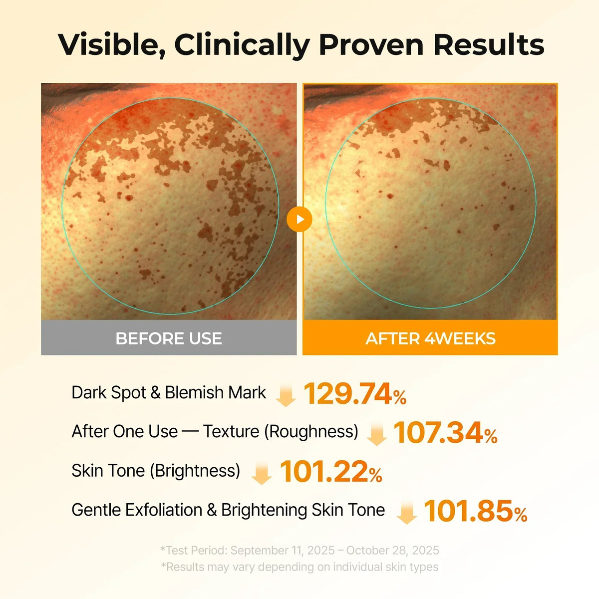 Kojic Acid Turmeric TX Toner Pads for Dark Spots and Uneven Skin Tone